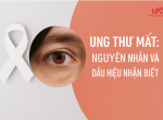 UNG THƯ MẮT: NGUYÊN NHÂN VÀ DẤU HIỆU NHẬN BIẾT