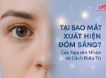 Tại Sao Mắt Xuất Hiện Đốm Sáng? Các Nguyên Nhân và Cách Điều Trị