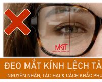 ĐEO KÍNH LỆCH TÂM CÓ NGUY HIỂM KHÔNG?