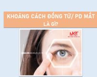 KHOẢNG CÁCH ĐỒNG TỬ (PD) CỦA MẮT LÀ GÌ?