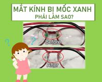 MẮT KÍNH BỊ MỐC XANH PHẢI LÀM SAO?